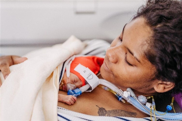 Auch dieses Frühchen erblickte im Kemperhof das Licht der Welt: Hautkontakt und Nähe zu den Eltern sind entscheidend für die Entwicklung der kleinen Kämpfer. Foto: Andrea Maxsisch