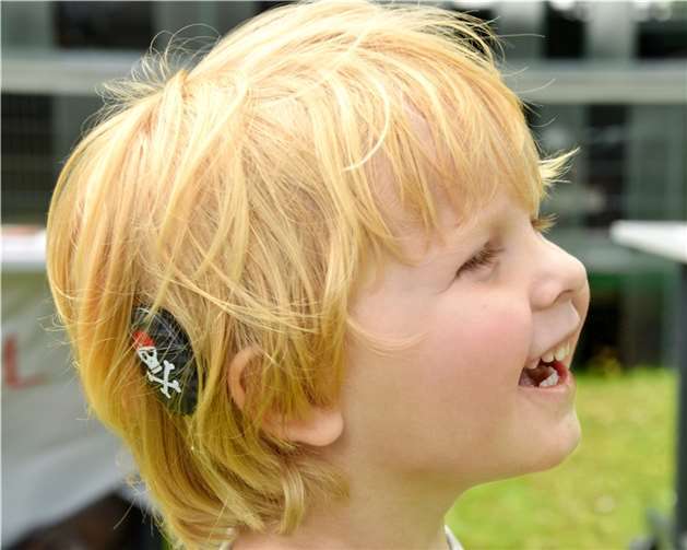 Das CI-Centrum Rhein-Mosel-Lahnfeiert 20-jähriges Bestehen.  Foto: Becker Hörakustik