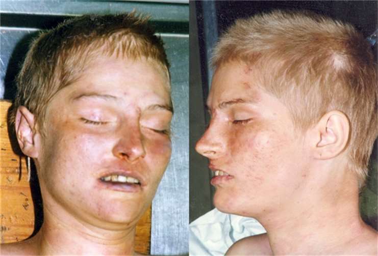 Das Gesicht der unbekannten Toten. Foto: Polizei RLP