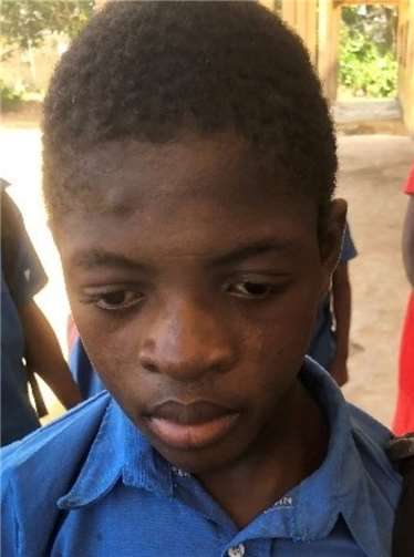 Das ist Che Neba Roderigo.Quelle: Bon Secours Kamerun