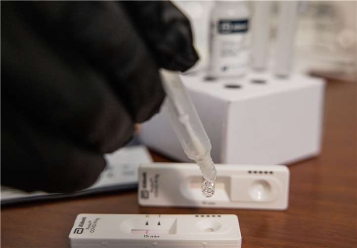 Der Antigen-Test selbst in der modernen Form mit einem kurzen Teststäbchen dauert nur eine Minute, und nach einer halben Stunde wird das Ergebnis entweder aufs Smartphone übermittelt oder auf Papier ausgedruckt.