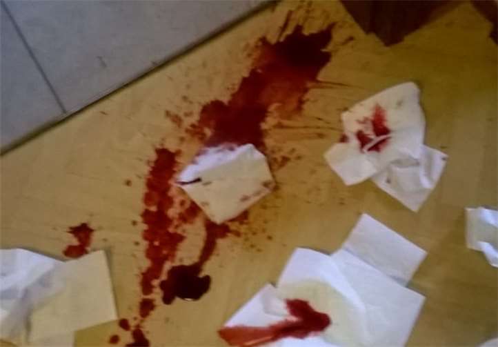 Der von Milow aufgenommene Giftköder führte zu blutigem Erbrechen und Durchfall.