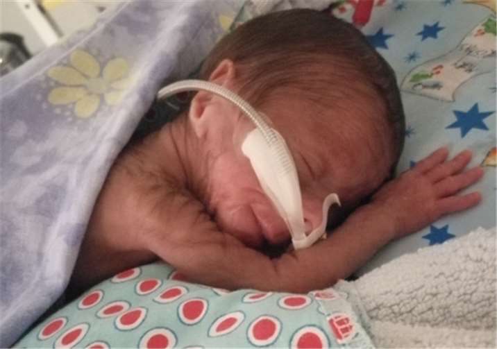 Die kleine Ilkim kam vier Monate zu früh auf die Welt.Fotos: Bunter Kreis Rheinland e.V.