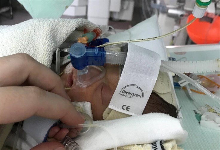 Die kleine Sophie kurz nach der Geburt. Foto: Bunter Kreis 