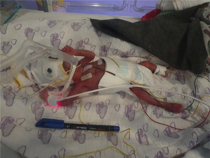 Die kleine Zeynabe durfte nach ihrem schweren Start ins Leben nun endlich mit ihren Eltern nach Hause. 