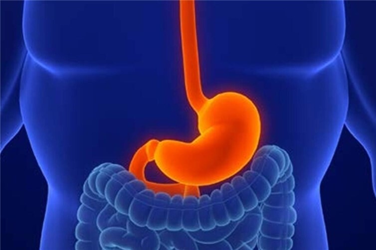 Reflux – Moderne Ansätze gegen eine Volkskrankheit