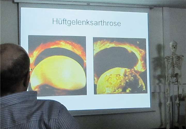 Viele Informationen erhielten die Gäste beim Vortrag zum Thema „Das künstliche Hüftgelenk“. privat